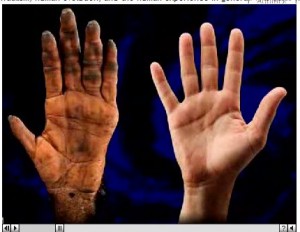 opposable_thumbs